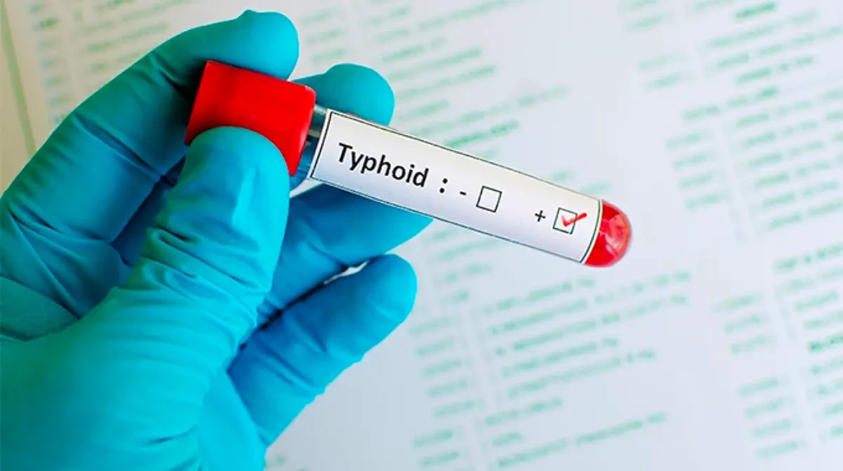Typhoid scare hits Harare.