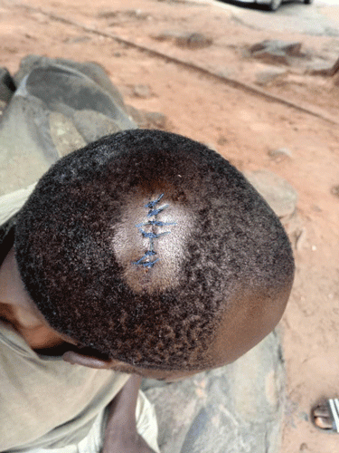 10 injured in machete attack over gold claims