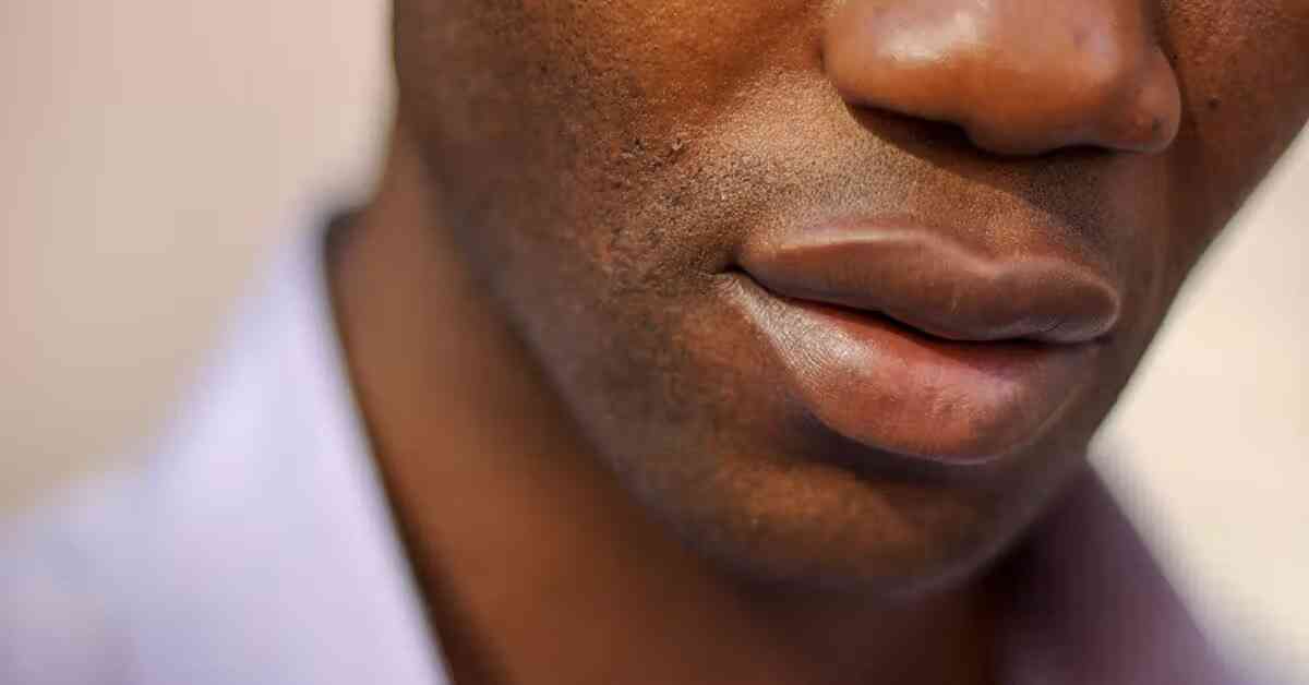 Beyond cosmetic care: The critical importance of lip health