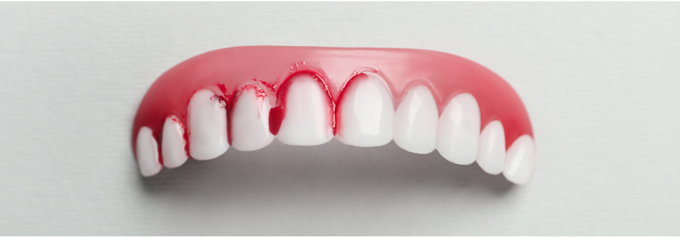 Beyond the brush: What do bleeding gums signify?