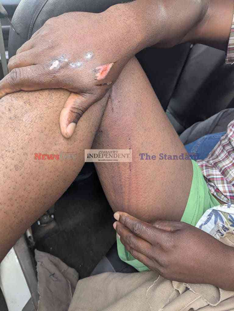 Madhuku’s NCA says members abducted 