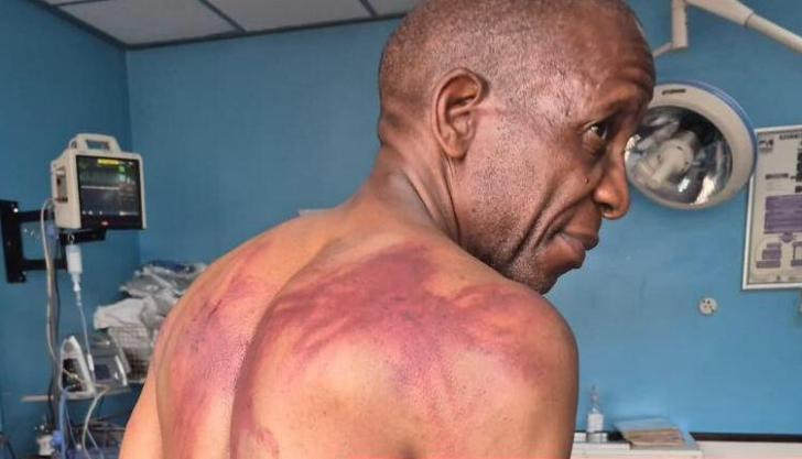 Violence as a strategy in Zim politics