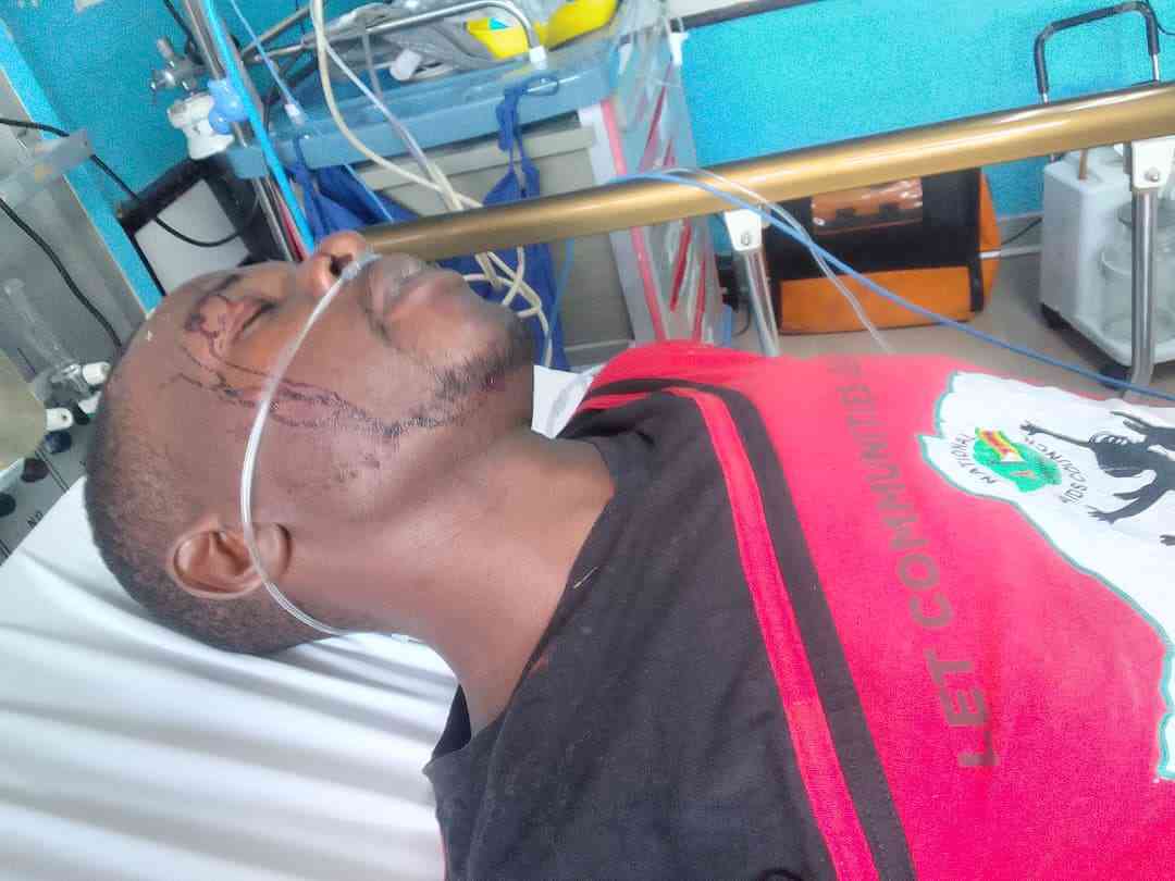 Madhuku assaulted, injured at his NCA offices 