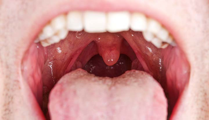 Scrubbed, dissolved and cracked: The invisible battle inside your mouth