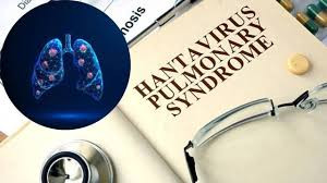 Zimbabwe says monitoring returning health workers after hantavirus exposure