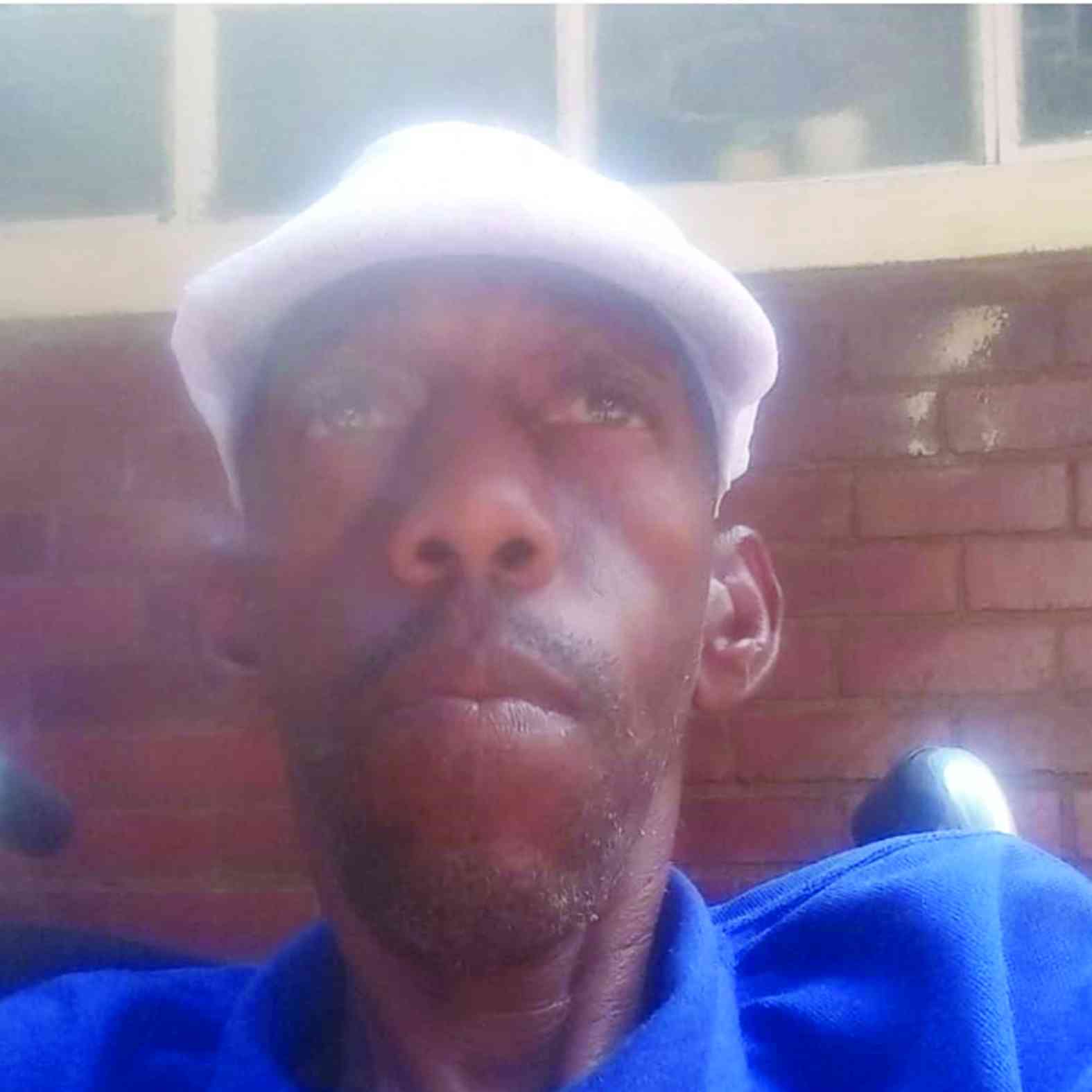 Bulawayo singer turns disability into music of hope