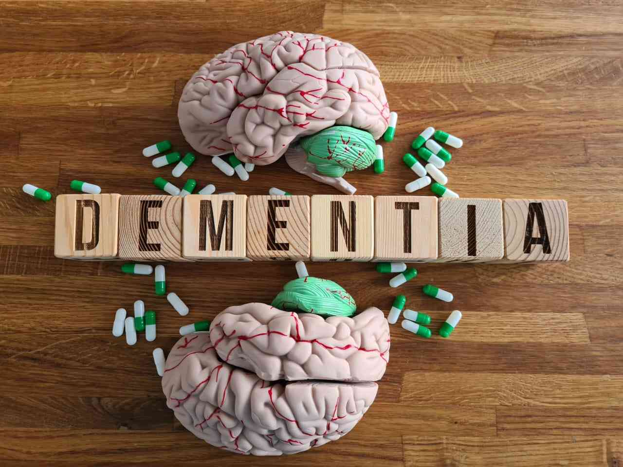 Senators sound alarm over dementia crisis in Zim