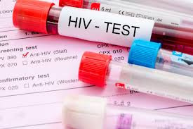 Old Magwegwe, Old Pumula identified as HIV hotspots