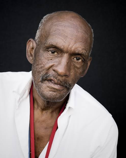 Zim cannot afford to ignore the silent dementia crisis
