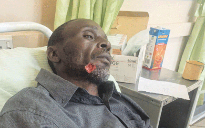 Dete man survives hyena attack
