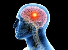 Not all brain tumours are cancerous