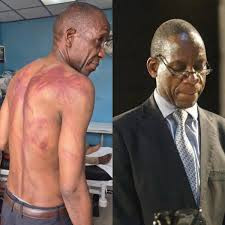 Constitutional amendment No. 3: The scourge of  state-condoned violence against those opposed to it