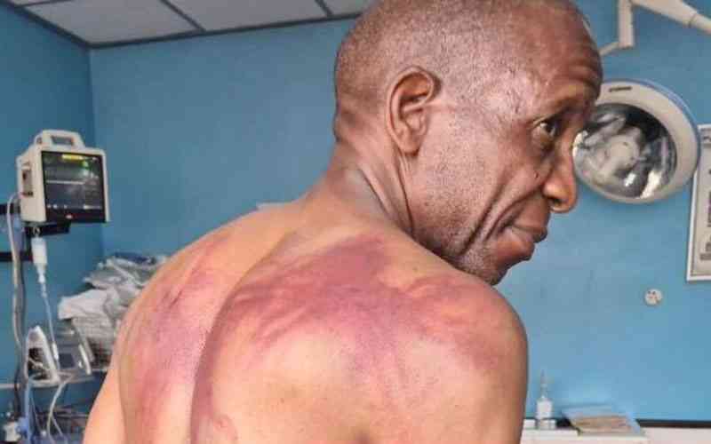 Opponents to choose between ‘beatings’ or ‘abductions’